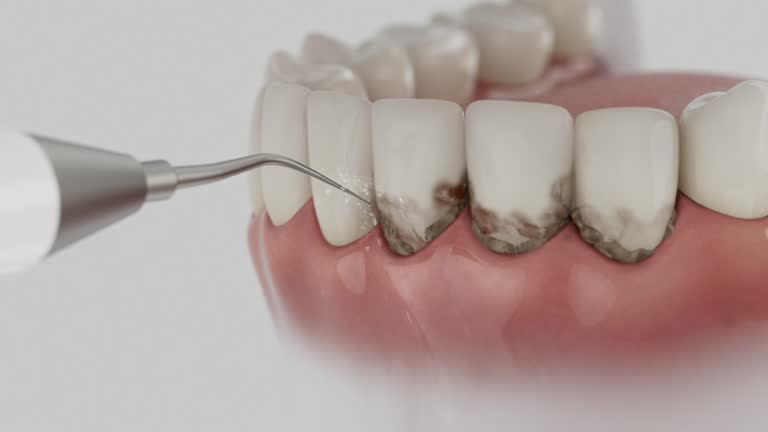 Reliable Dental Crowns And Bridges contractor in Sumter County County, GA by Dentist Open Now